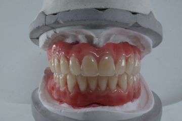 Протезы «Акрилайт» – новое поколение съемных стоматологических конструкций