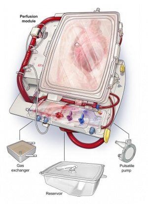Кардиологическая технология TransMedics® Organ Care System (OCS™) была использована при проведении первой в мире серии трансплантаций сердца взрослым пациентам от доноров после циркуляторной смерти (DCD-доноров) в Больнице Св. Винсента (Сидней, Австралия)