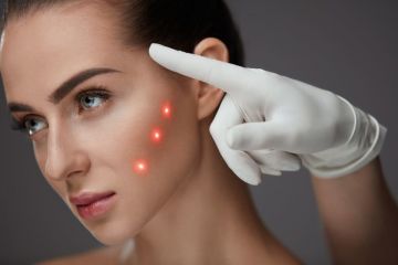Мадина Байрамукова: что нужно знать о лазерных процедурах для лица