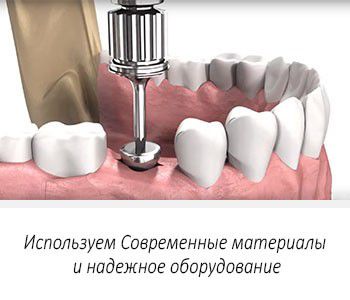 Эстетическое и функциональное здоровье зубов и всей полости рта важный аспект жизни современного человека.