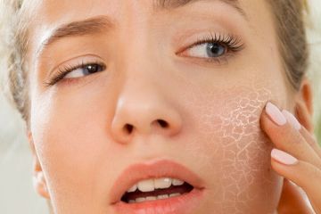 Мадина Байрамукова: о каких проблемах со здоровьем расскажет ваша кожа на лице