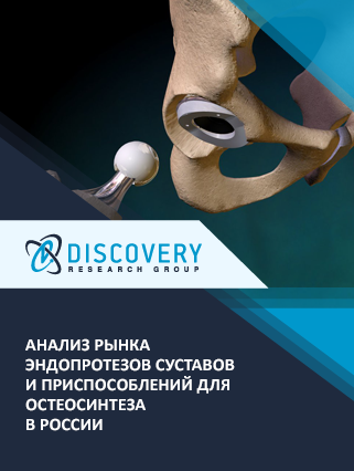 Анализ рынка эндопротезов суставов и приспособлений для остеосинтеза в России