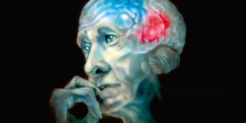 Болезнь Альцгеймера как наказание за невыполненную программу собственного совершенствования