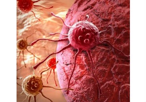 Израильские ученые совершили очередной прорыв в области химиотерапии
