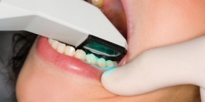 Стоматология на Позняках «Вива-Дент»: «Уже через год украинцы будут протезировать зубы за один день»